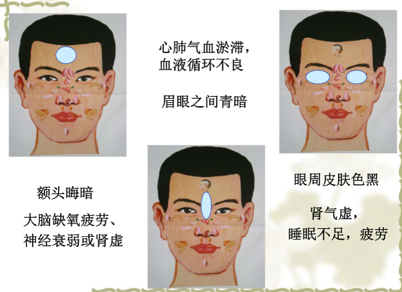 面部望诊与面部刮痧诊断1