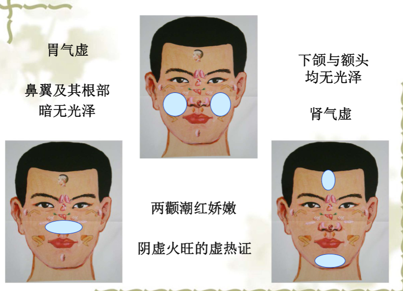 面部望诊与面部刮痧诊断1