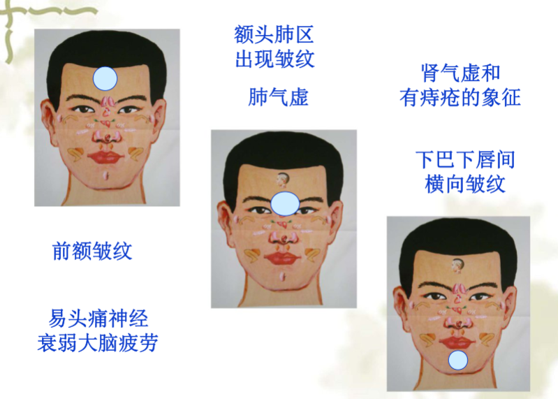 面部望诊与面部刮痧诊断1