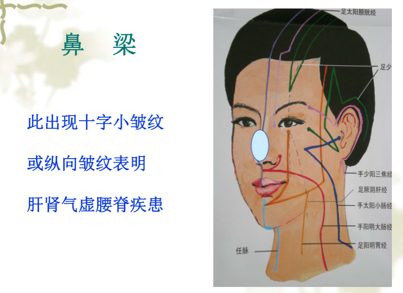 面部望诊与面部刮痧诊断2