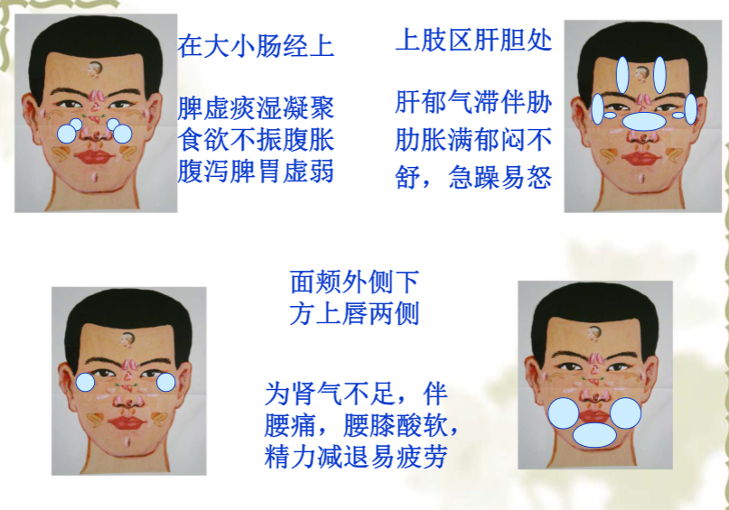 面部望诊与面部刮痧诊断2