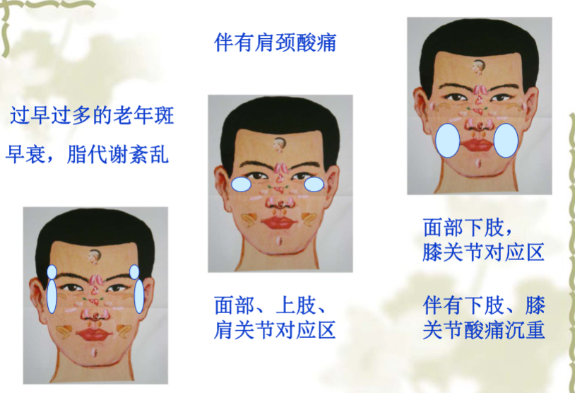 面部望诊与面部刮痧诊断2